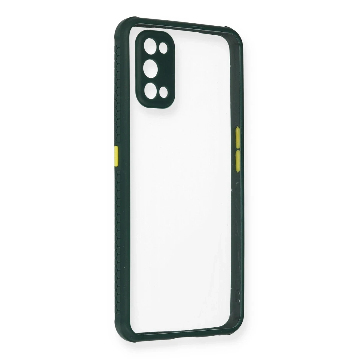 Newface Realme 7 Pro Kılıf Miami Şeffaf Silikon - Koyu Yeşil