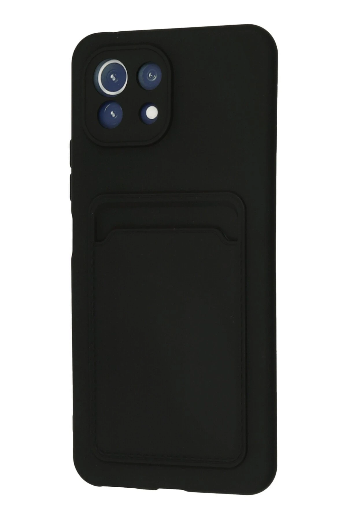 Newface Xiaomi Mi 11 Kılıf Kelvin Kartvizitli Silikon - Siyah