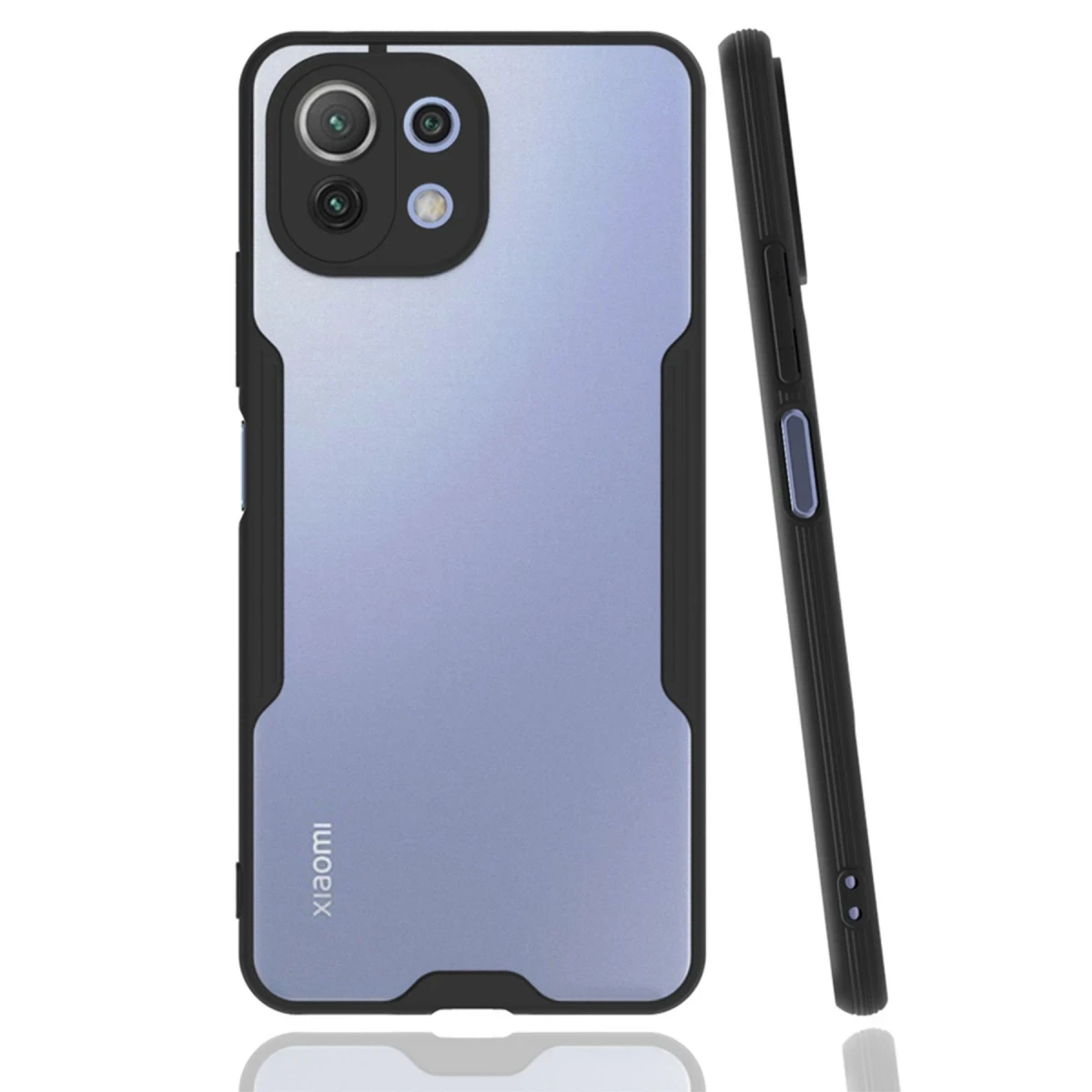 Newface Xiaomi Mİ 11 Lite Kılıf Platin Silikon - Siyah — görsel 3