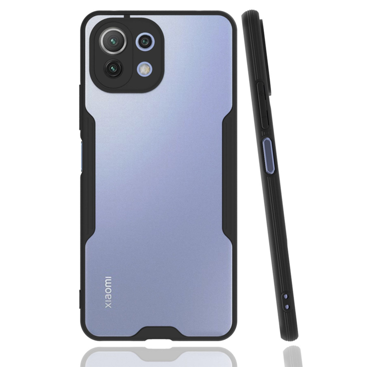 Newface Xiaomi Mİ 11 Lite Kılıf Platin Silikon - Siyah — görsel 5