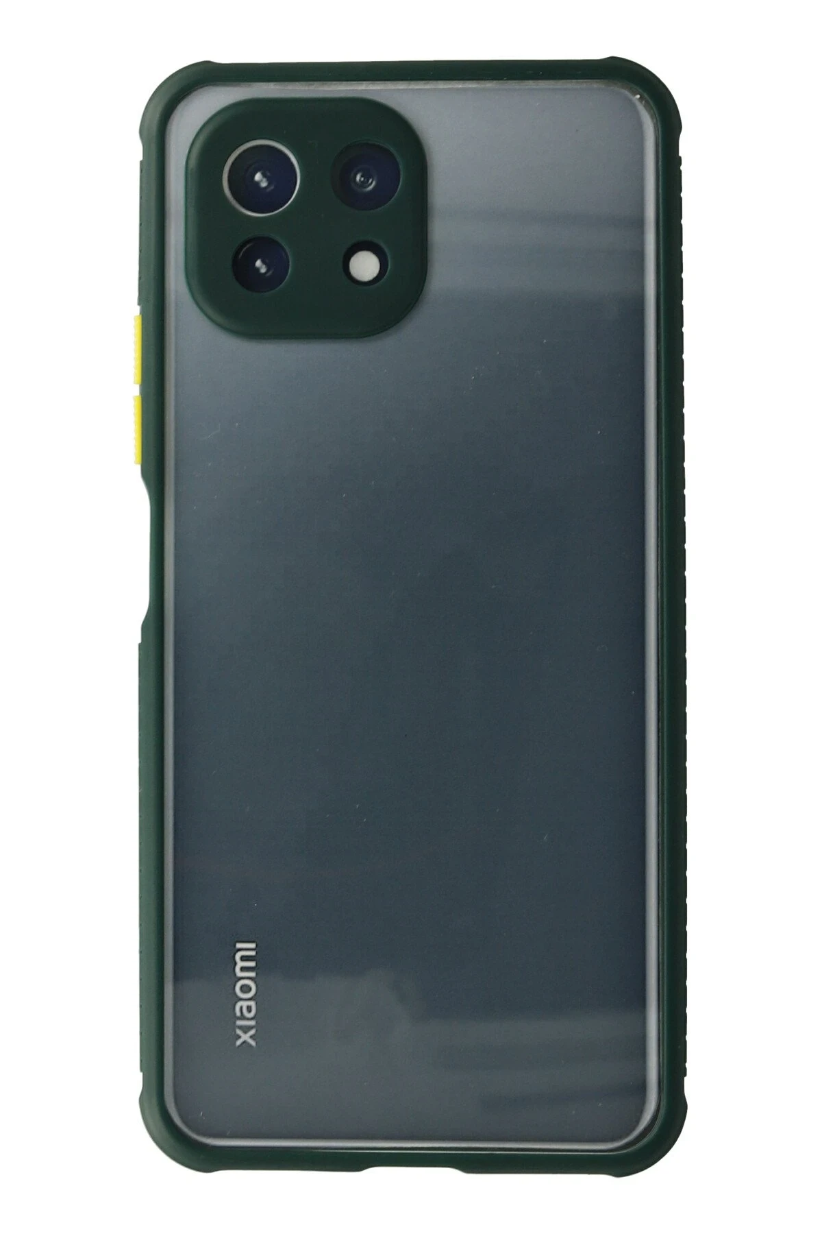 Newface Xiaomi Mİ 11 Lite Kılıf Miami Şeffaf Silikon - Koyu Yeşil
