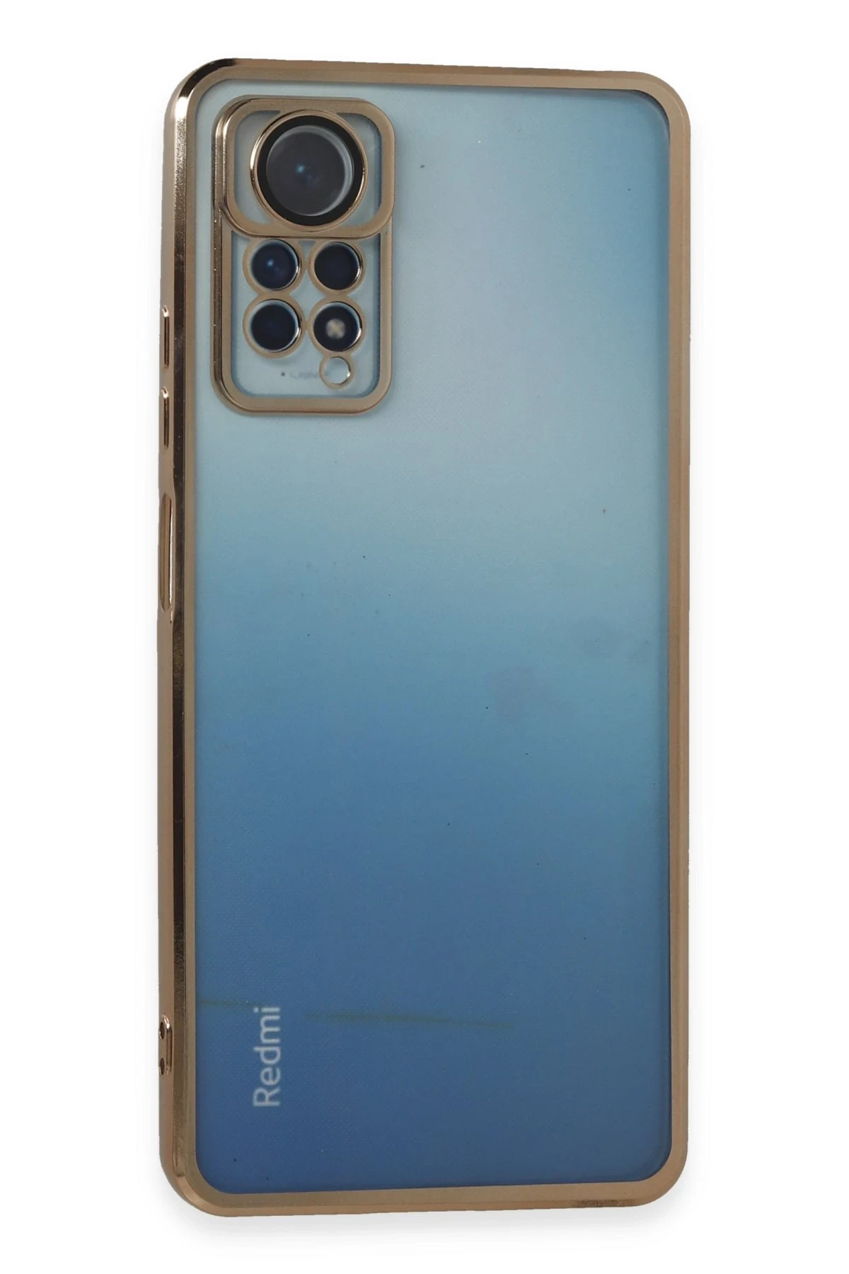 Newface Xiaomi Redmi Note 11 Pro Kılıf Razer Lensli Silikon - Gold