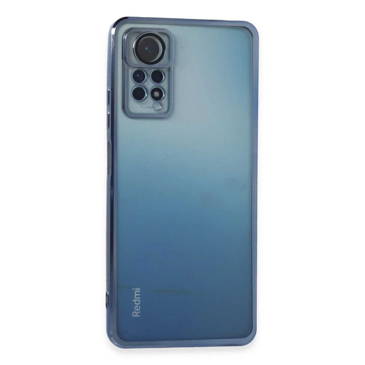 Newface Xiaomi Redmi Note 11 Pro Kılıf Razer Lensli Silikon - Açık Mavi