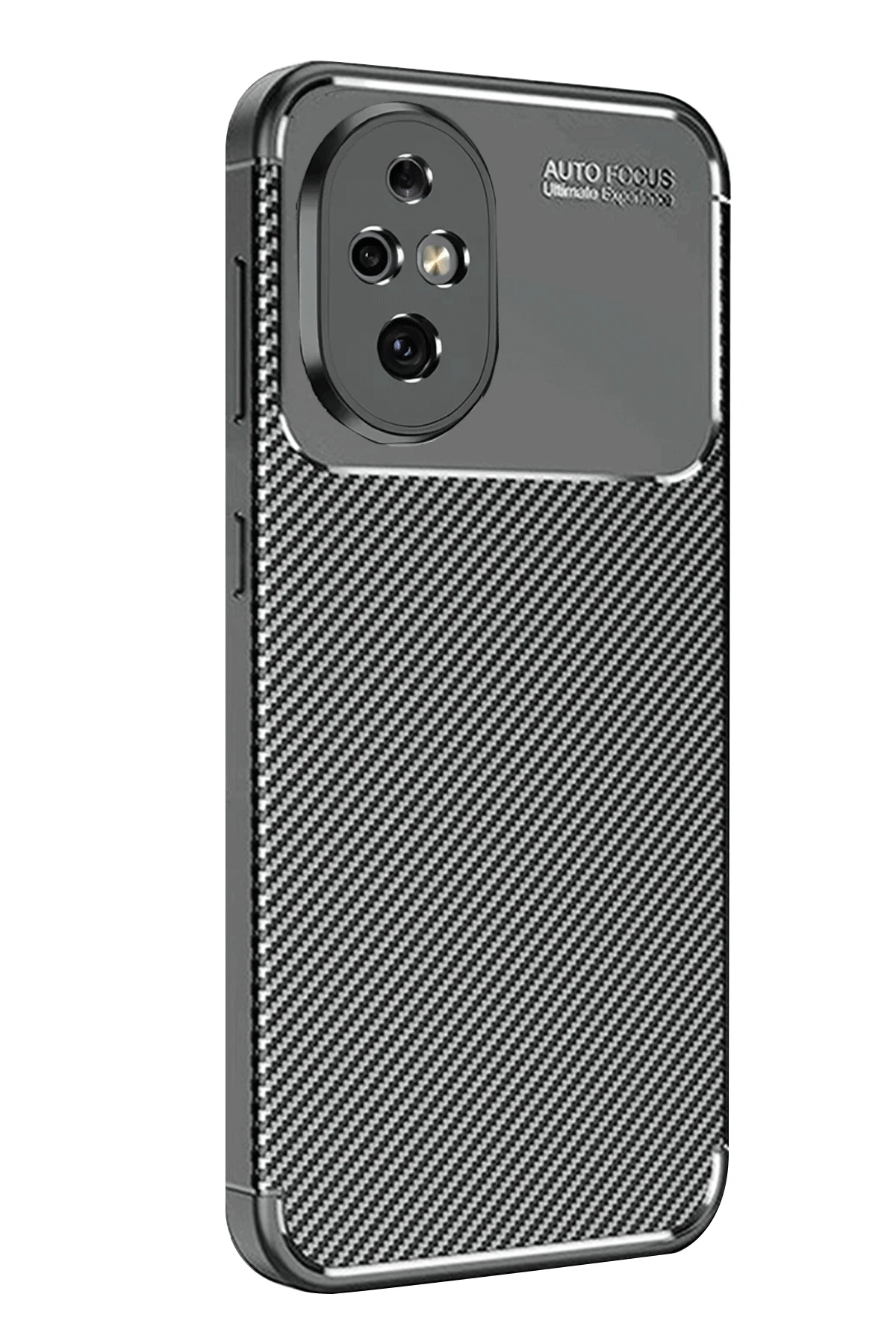 Newface Honor 200 Kılıf Auto Focus Karbon Kapak - Siyah — görsel 3