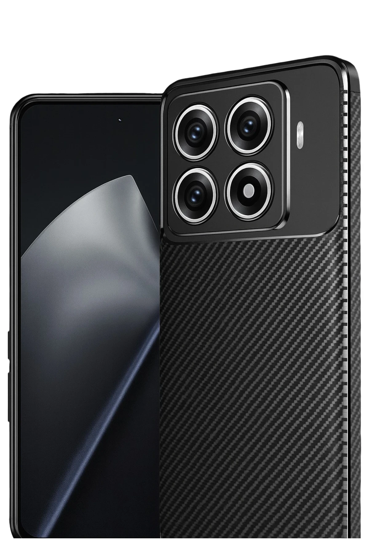 Newface Xiaomi Mi 15T Pro Auto Focus Karbon Kapak - Siyah