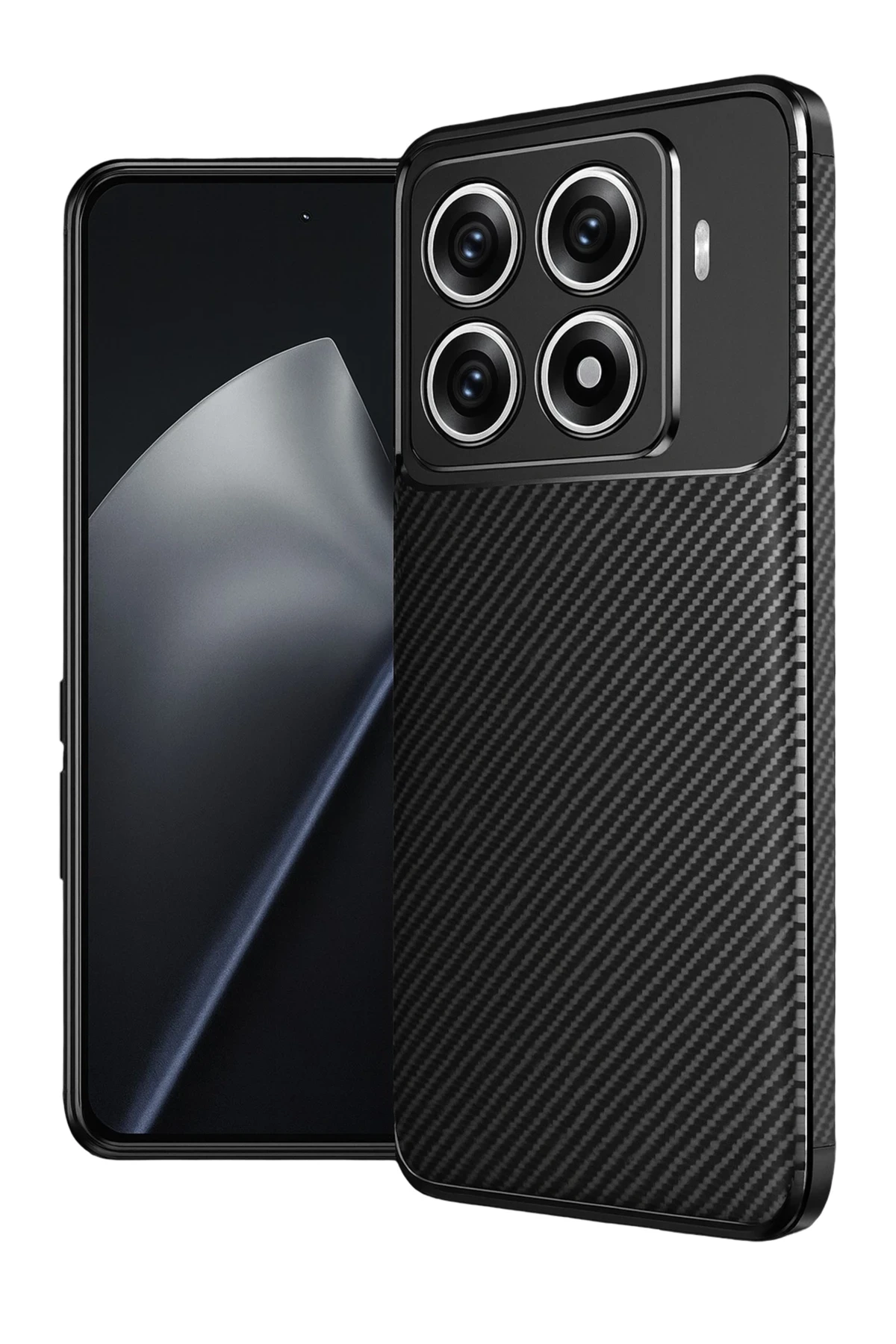 Newface Xiaomi Mi 15T Pro Auto Focus Karbon Kapak - Siyah