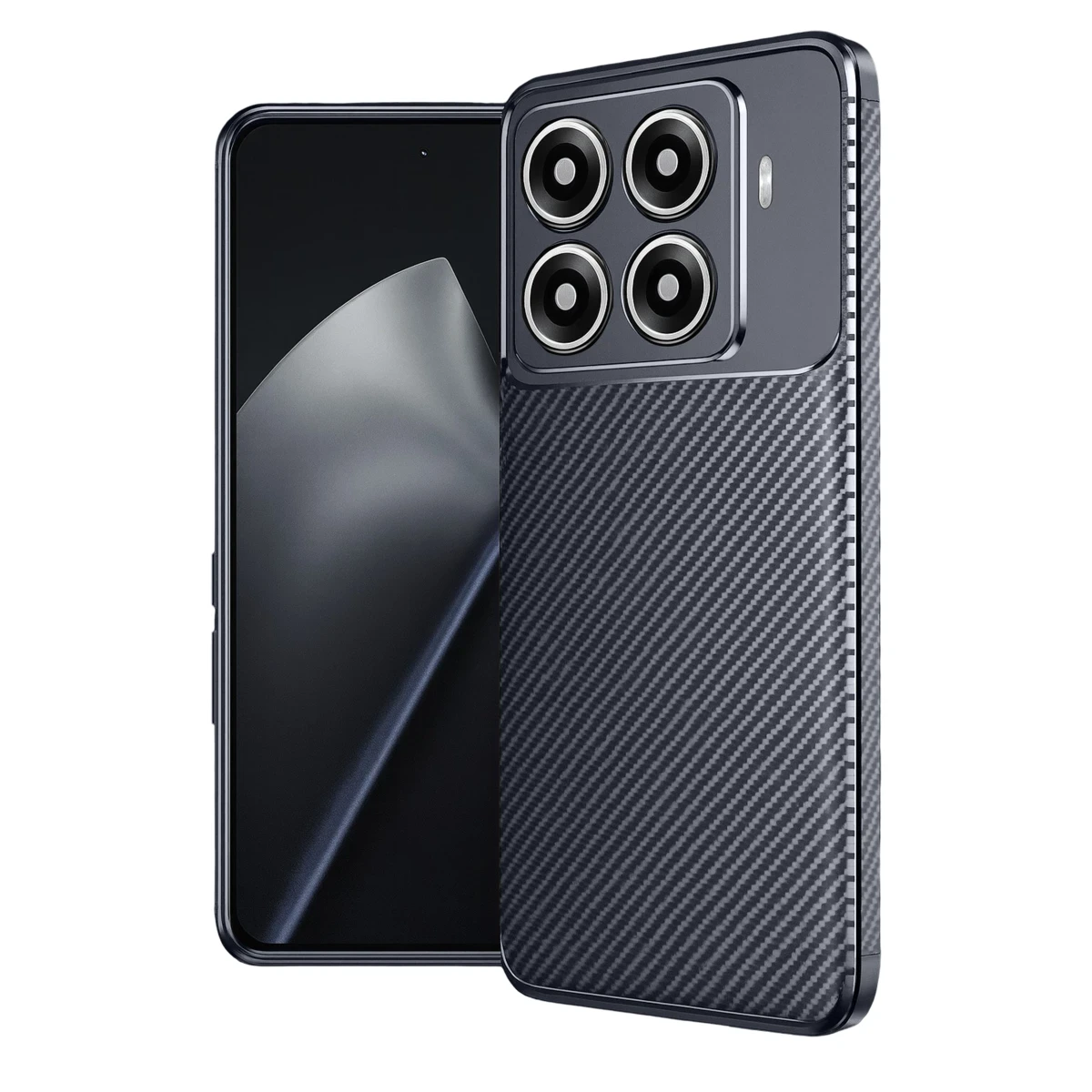 Newface Xiaomi Mi 15T Pro Auto Focus Karbon Kapak - Lacivert