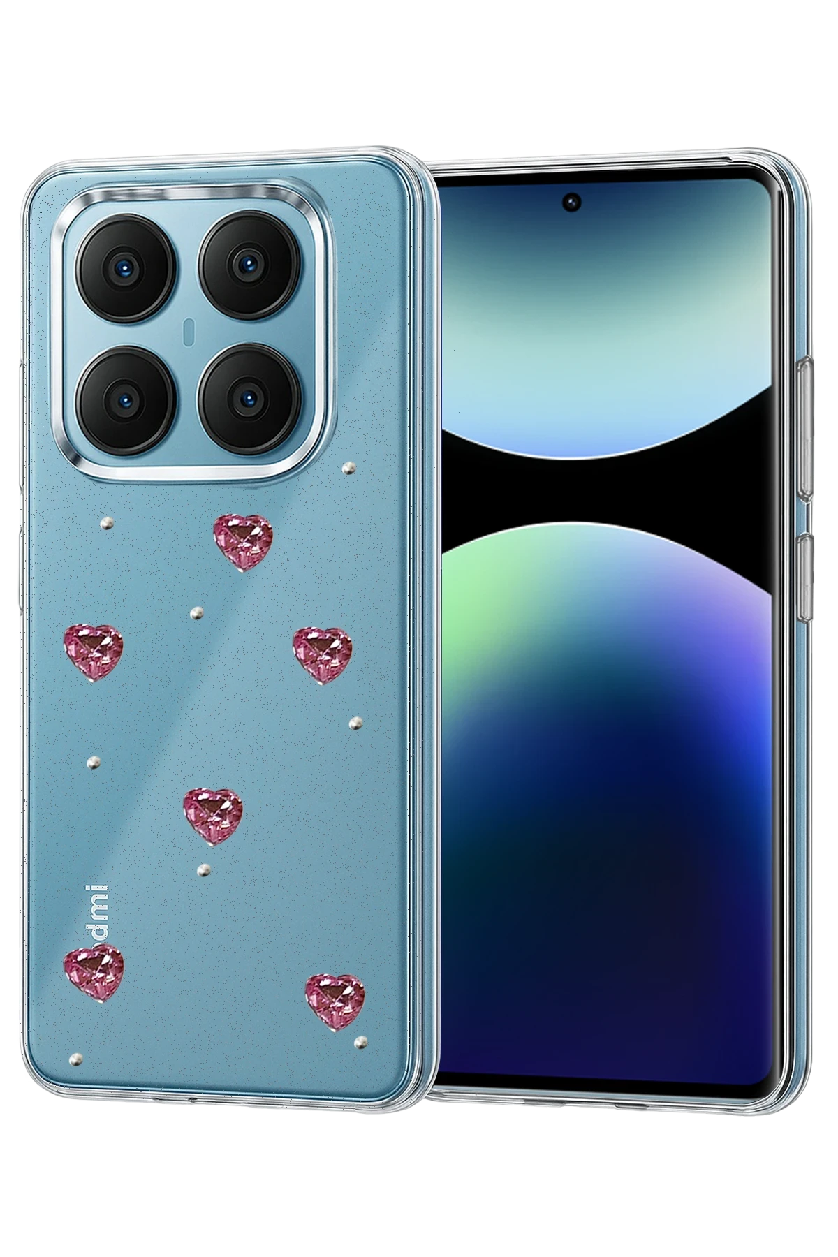 Newface Xiaomi Redmi Note 14 Pro 4G Fiyonk Desenli Kapak - Desen 3