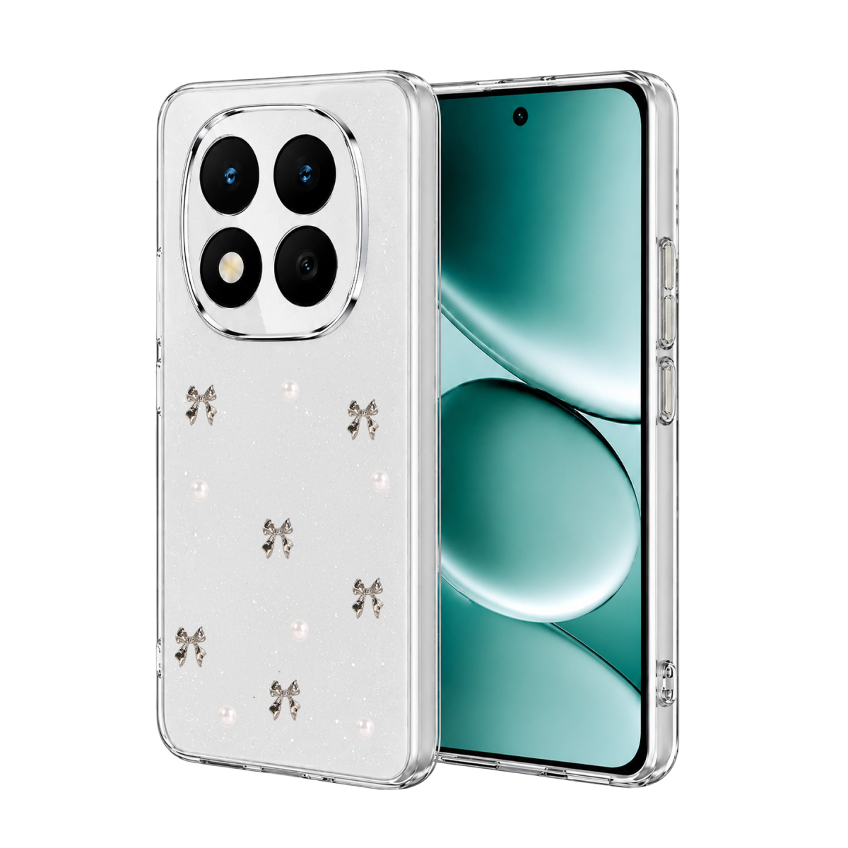 Newface Xiaomi Redmi Note 15 Pro 5G Fiyonk Desenli Kapak - Desen 8